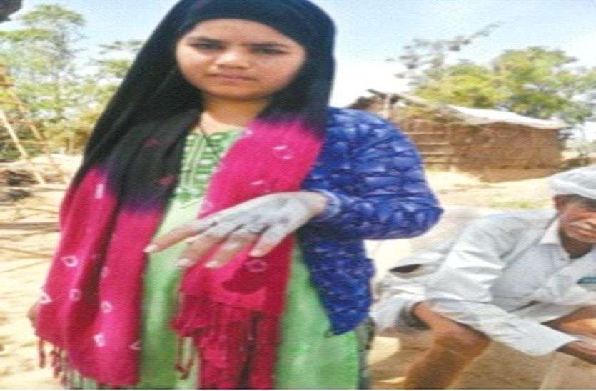 सिलेंडर बचाने के फेर में बालिका ने उठा लिया यह कदम सिलेंडर बचाने के फेर में बालिका ने उठा लिया यह कदम