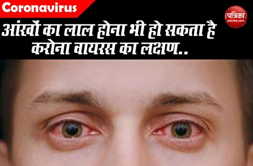Is Redness in the Eyes Can be a Symptom of Coronavirus? आंखों का लाल होना भी हो सकता है करोना वायरस का लक्षण, जानिए क्या-क्या होते है बदलाव