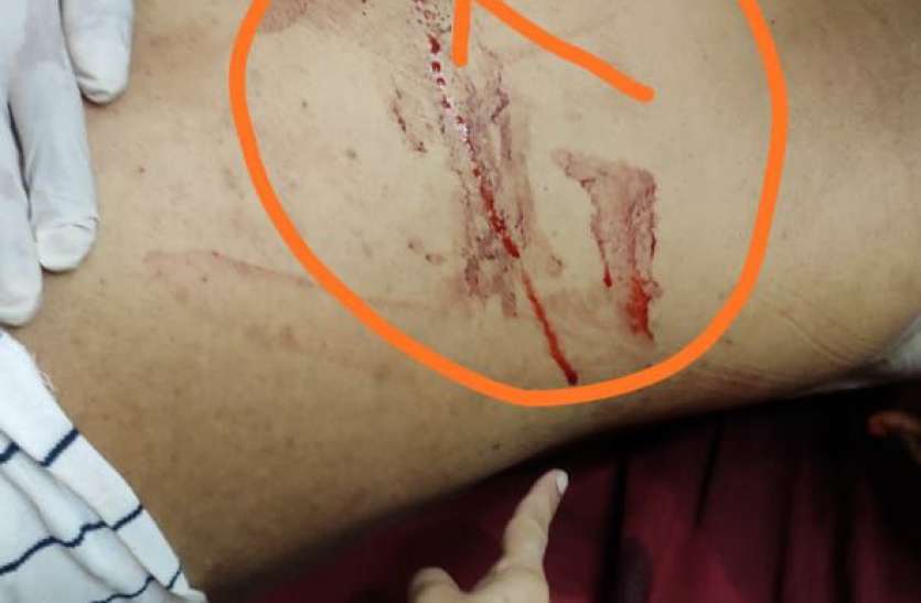murder1.jpg Firing and murder:‘तेरे से दोस्ती, तेरी जान लेने के लिए की थी’ कहकर ताबड़तोड़ फायरिंग कर सीने में उतार दी गोली