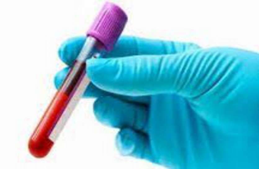 Corona virus : अहमदाबाद में 11 समेत राज्य में 16 नए मरीज 21 सहित तब्लीगी मरकज में शामिल पांच की रिपोर्ट निगेटिव