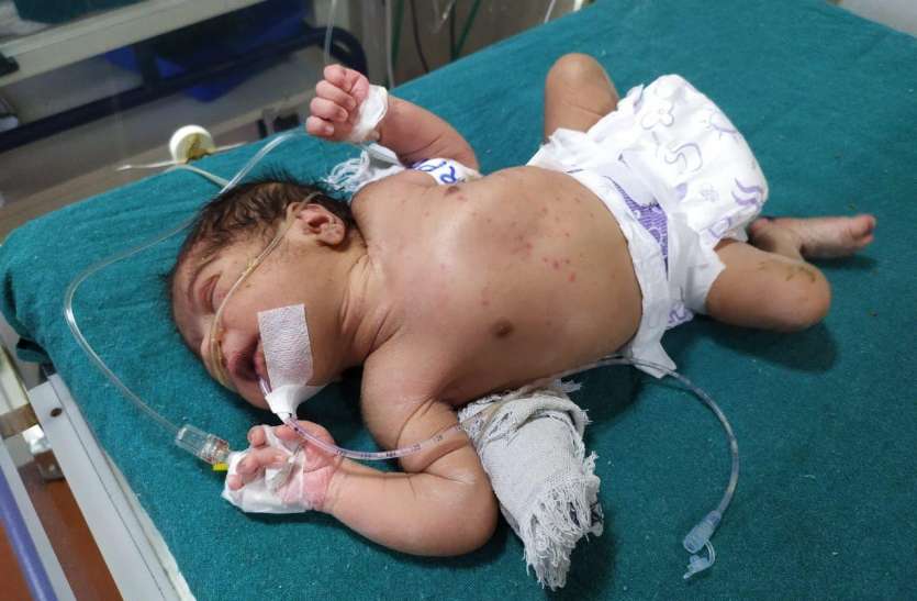 Newborn झाडिय़ों में रोता-बिलखता मिला नवजात शिशु
