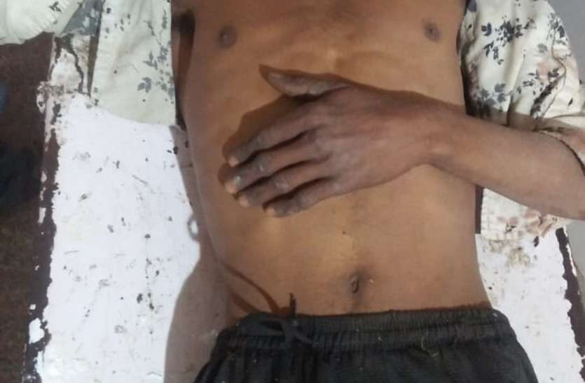 पत्नी की हत्या कर पति ने स्वयं किया आत्महत्या का प्रयास पत्नी की हत्या कर पति ने स्वयं किया आत्महत्या का प्रयास
