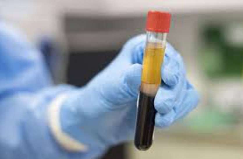 Plasma therapy : कोरोना को मात देने वालों के रक्त से होगा कोरोना का उपचार! Plasma therapy : कोरोना को मात देने वालों के रक्त से होगा कोरोना का उपचार!