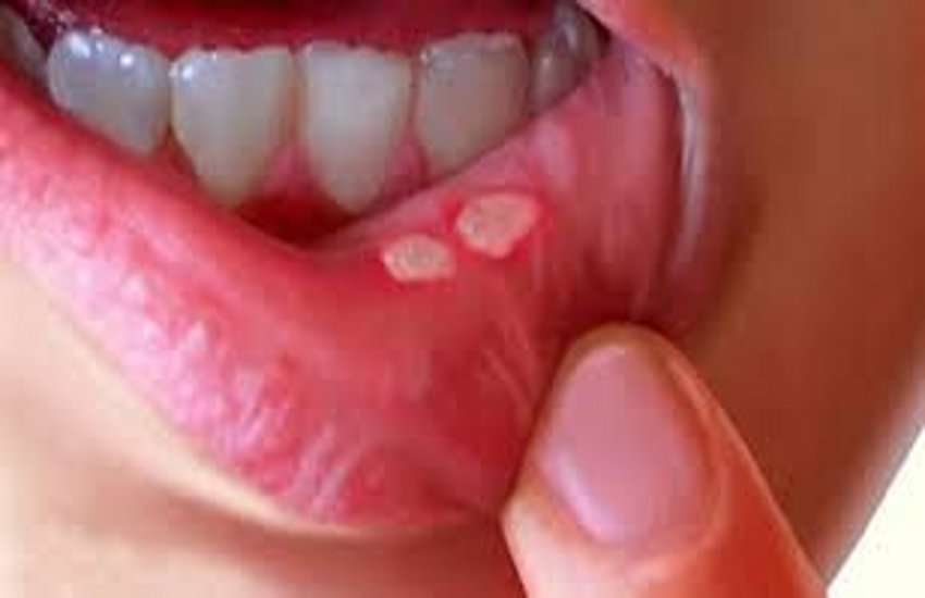 इसके उपयोग से मुंह से संबंधित बीमारी खत्म हो जाती है, जानिए अभी आप इनके बारे में