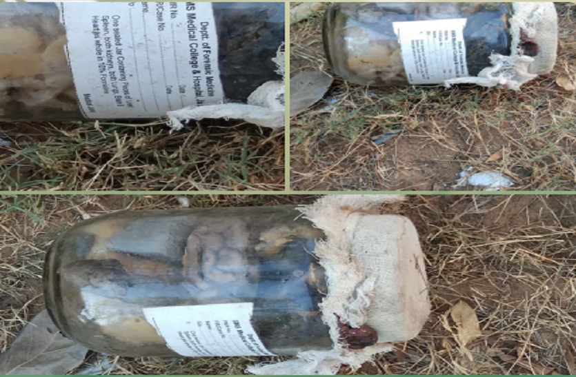 Human Organs Found In Jaipur : Human Organs Meet On Road SMS अस्पताल के स्टीकर लगे जार में मिले मानव अंग, लॉकडाउन के बावजूद जार आखिर कैसे पहुंचा 15 K.M. दूर