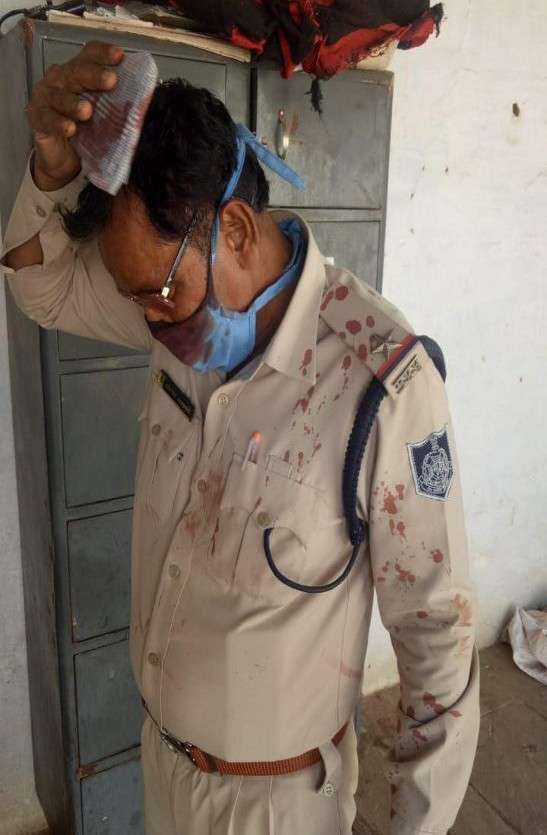 injured doctor-police in mp, home minister spoke to asi and doctor