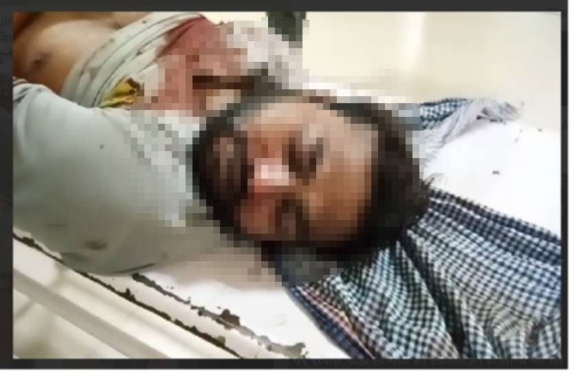 man murder in gwalior लॉकडाउन में युवक की हत्या, लाठी-डंडों से पीट-पीटकर छीन ली जान