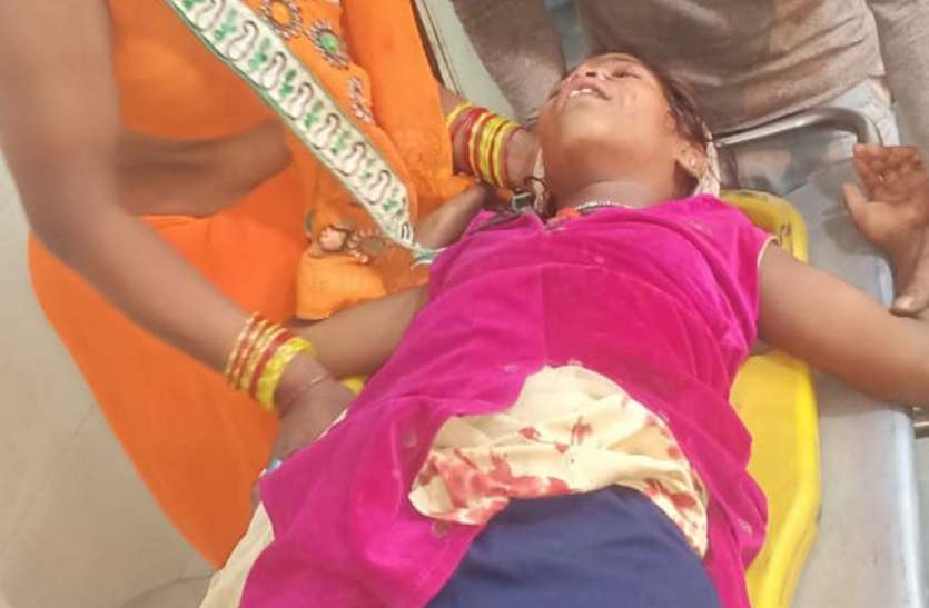 Crime: Bike rider hit girl, breaks leg क्राइम: बाइक सवार ने बालिका को मारी टक्कर, टूट गया पैर