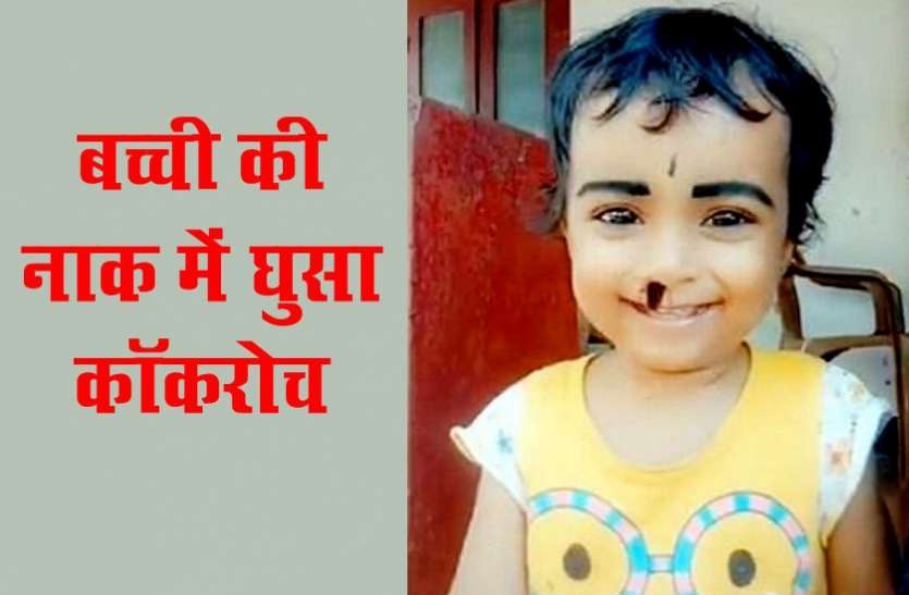 Tiktok Viral Video TikTok वीडियो बना रही थी मां, बेटी की नाक में घुसा कॉकरोच