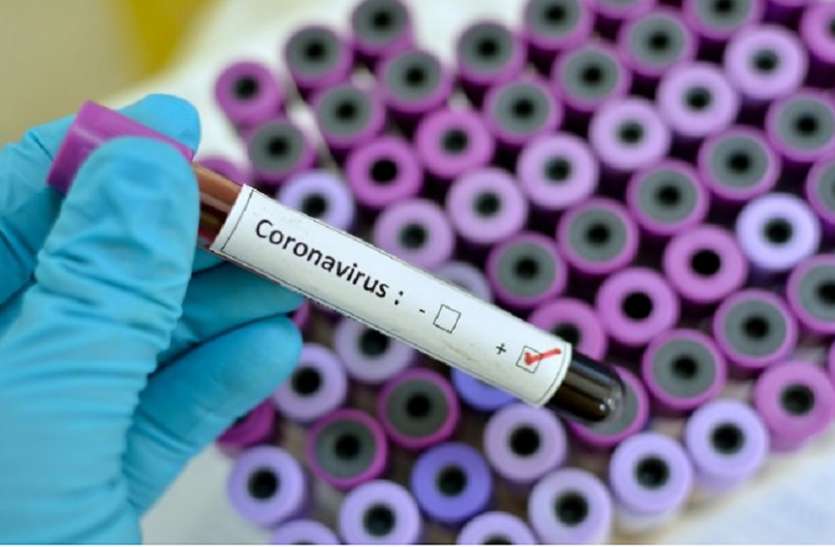 कोरोना वायरस प्रतीकात्मक फोटो सिंगरौली में कोरोना का संक्रमण तेज