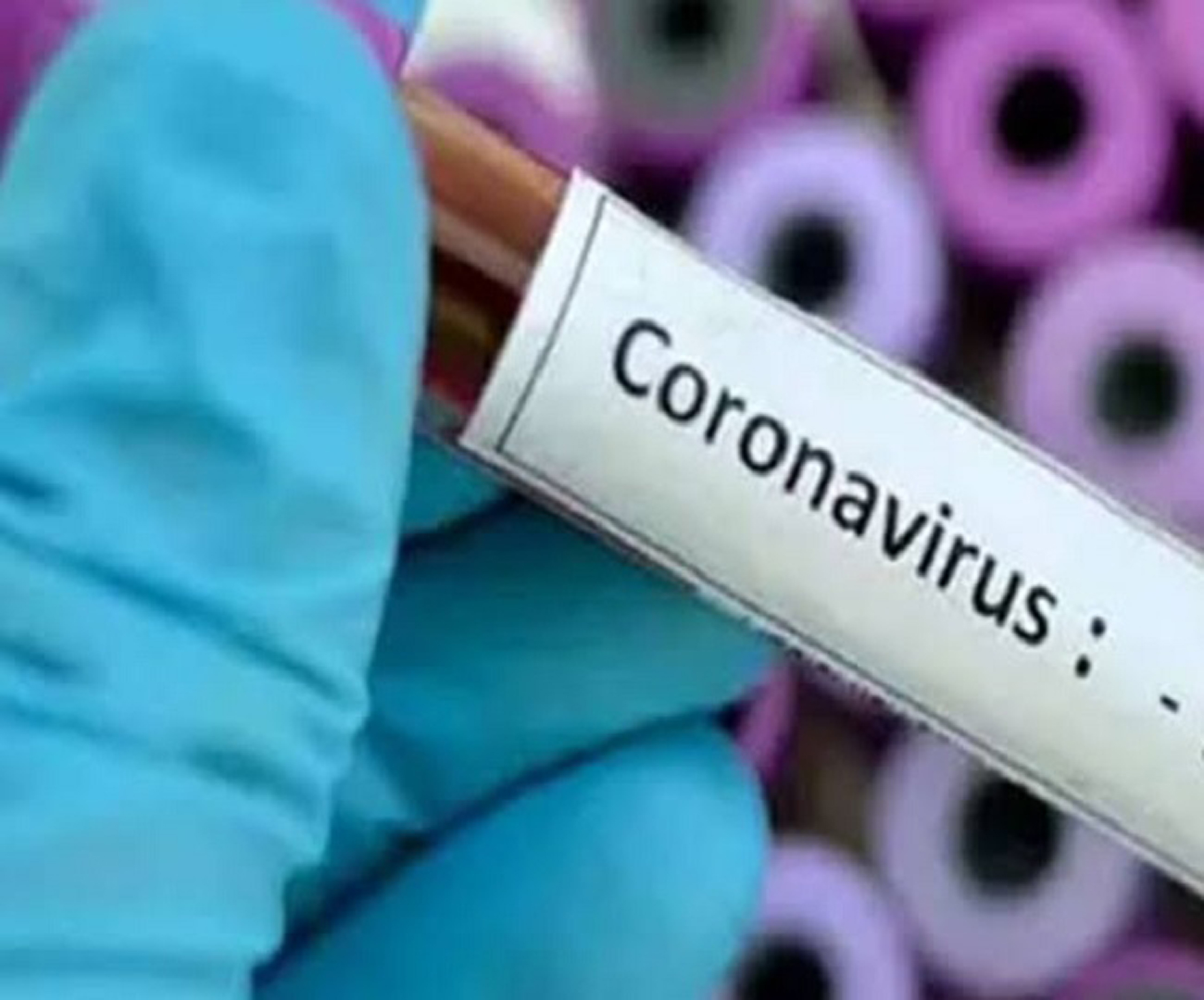 Covid-19 Update : कानपुर में फिर फूटा कोरोना बम, 24 घंटे में मिले नए 13 संक्रमित
