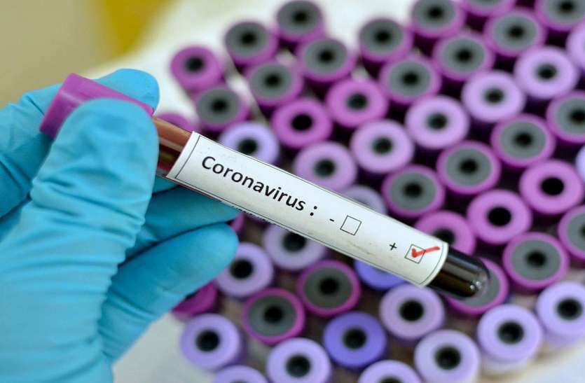 coronavirus पूरे भारत में कोरोना परीक्षण का सबसे कम शुल्क चंडीगढ़ में