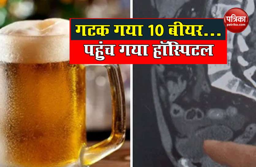 Man holds urine for 18 hours after drinking 10 beers his bladder ruptures पहले एक साथ पीया 10 Beers, फिर 18 घंटे तक रोका Urine, स्कैन में डॉक्टर्स को दिखी ये खौफनाक चीज
