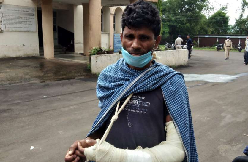 The compounder tied the plaster, referred to Jabalpur कंपाउंडर ने बांध दिया प्लास्टर, जबलपुर कर दिया रैफर