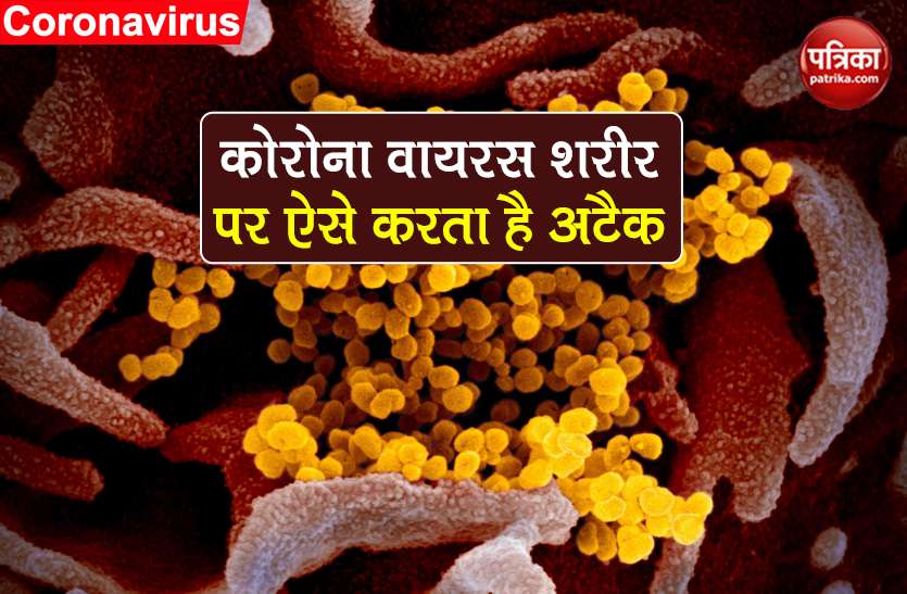 coronavirus scientists traced pro viral and anti viral genes covid-19 Coronavirus: शरीर के अंदर कैसे फैलता है कोरोना वायरस? वैज्ञानिकों ने किया चौंकाने वाला खुलासा