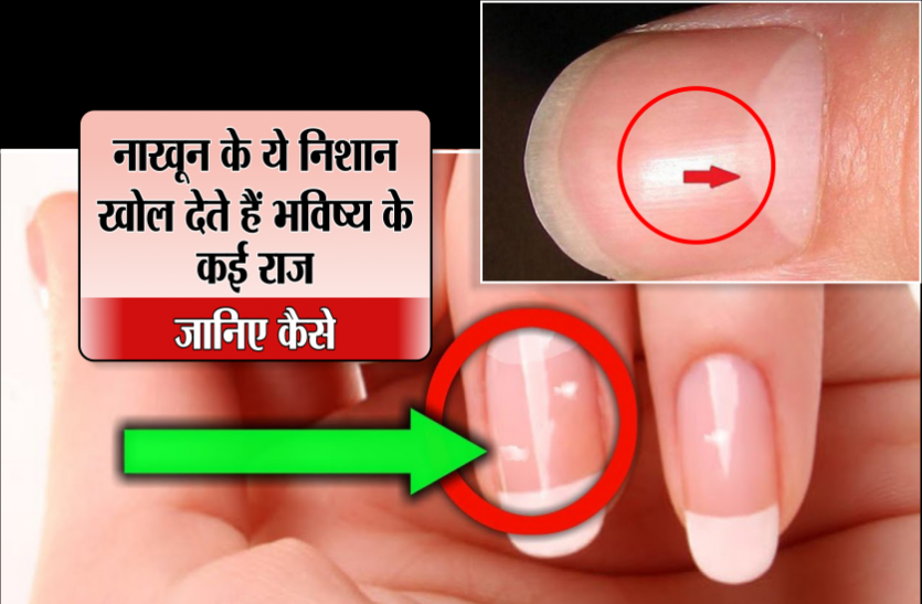 04_2_4840886_835x547-m.png नाखून में हैं सफेद निशान, तो आप है भाग्यशाली, जानिए अपने नाखून के बारे में सबकुछ