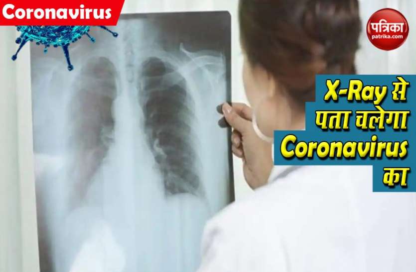 छाती के X-Ray से लगाया जाएगा Coronavirus का पता, रिसर्च में किया गया अनोखा दावा छाती के X-Ray से लगाया जाएगा Coronavirus का पता, रिसर्च में किया गया अनोखा दावा
