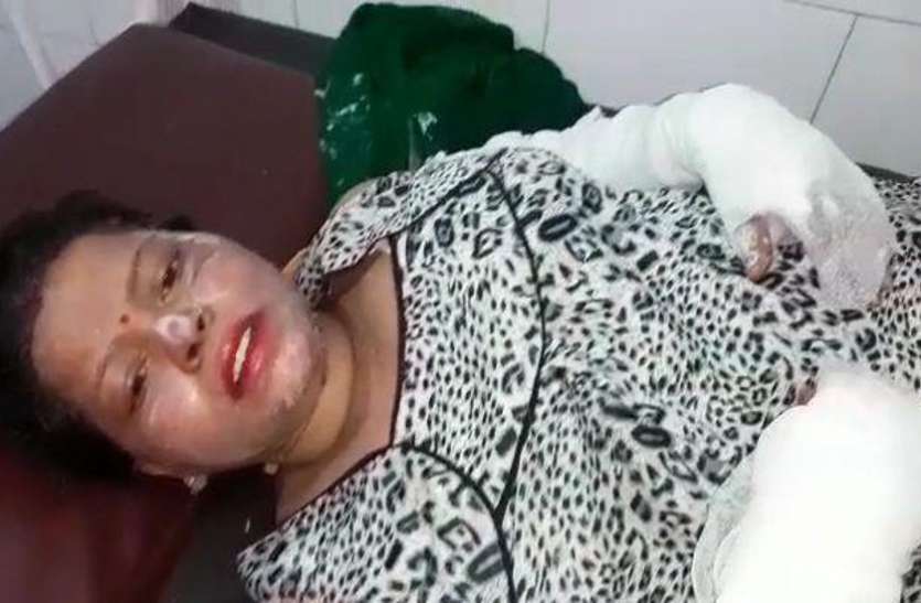 ghaziabad2.jpg खाना बनाते समय पतंग के मांझे से टच हुआ महिला का हाथ, जोरदार ब्लास्ट के साथ बुरी तरह झुलसी