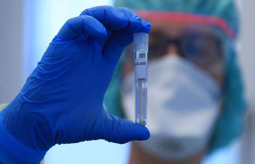 coronavirus-testing-scaled-e1586165575726.jpg