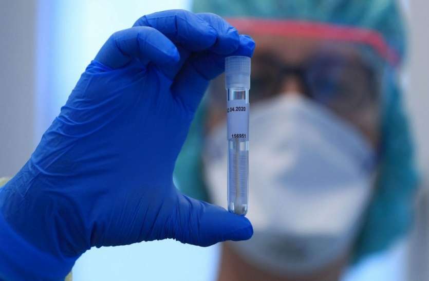 coronavirus-testing-scaled-e1586165575726.jpg Coronavirus: छत्तीसगढ़ के इस जिले में मिले तीन और कोरोना पॉजिटिव, कुल 153 संक्रमित