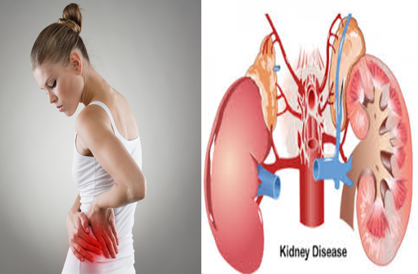 लंबे इंफेक्शन से किडनी होता है ये नुकसान लंबे इंफेक्शन से किडनी होता है ये नुकसान