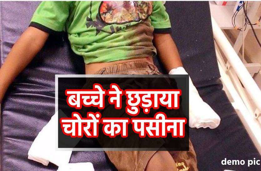 bachha.jpg चोरों से भिड़ गया 14 साल का बच्चा, लहूलुहान होने के बाद भी नहीं छोड़ी साइकिल