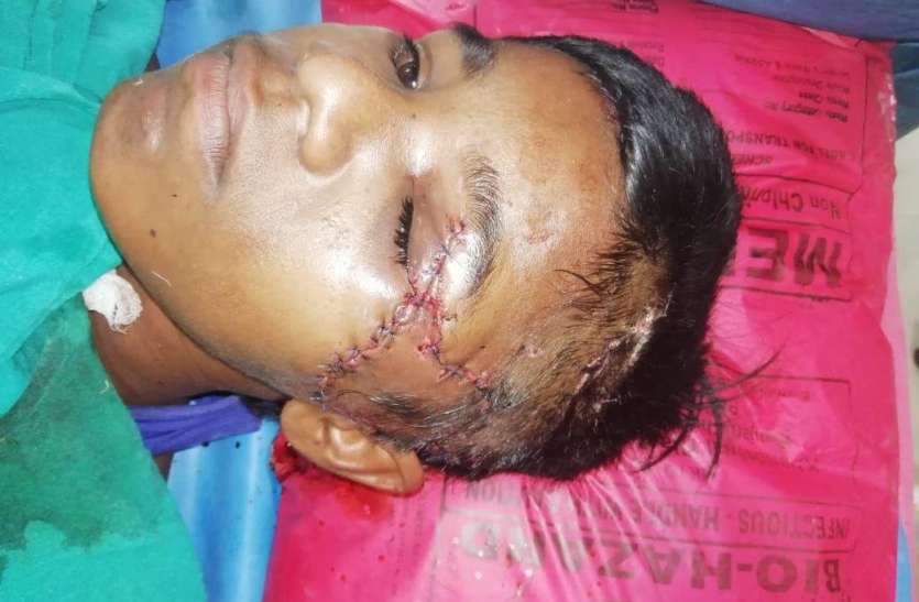 New life given to disabled child by performing a three-hour operation समझाना मुश्किल था, इशारों में दी हिम्मत, तीन घंटे का ऑपरेशन कर दिव्यांग बच्चे को दी नई जिंदगी