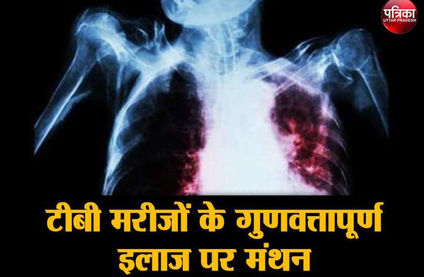 टीबी मरीजों के गुणवत्तापूर्ण इलाज पर मंथन टीबी मरीजों के गुणवत्तापूर्ण इलाज पर मंथन