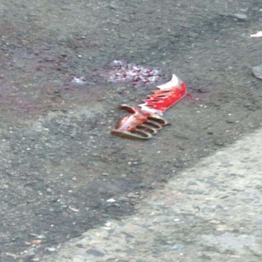ATTACK : दो जनों ने धारदार हथियारों से मनपा के सफाई कर्मी पर किए दर्जनों वार