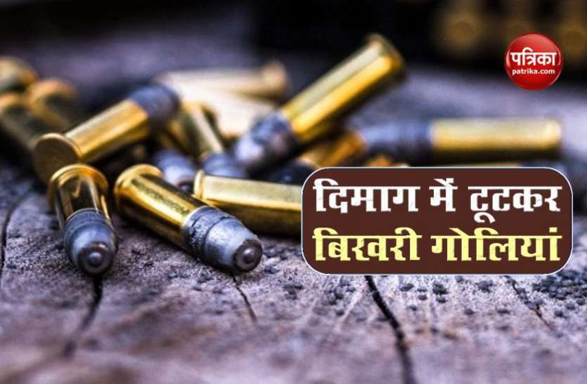 goli1.jpg दिमाग में फंसी गोली के 100 टुकड़ों को निकाल डॉक्टरों ने हासिल की कामयाबी, 5 घंटे तक चली सर्जरी