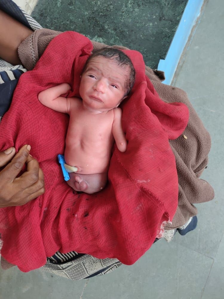 baby-born-with-no-legs-and-incomplete-hands