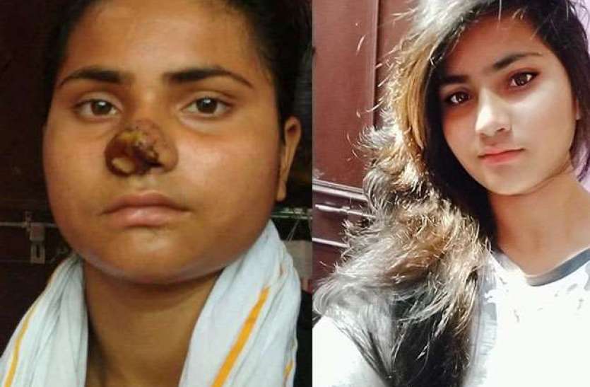 sisters.jpg मां ने पकड़ा और छोटी बहन ने बड़ी बहन की नाक काट दी
