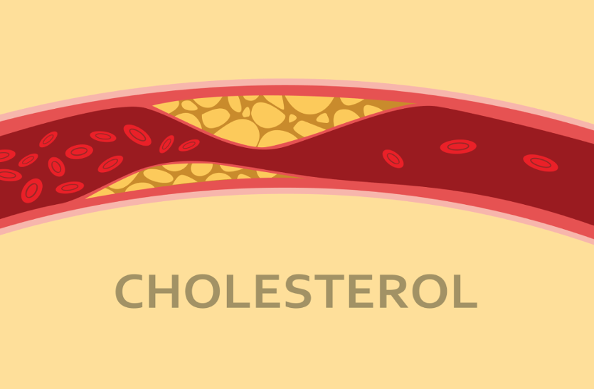 Learn Special Tips To Control Cholesterol Level क ल स ट र ल ल वल क क ट र ल करन च हत ह त आपक क म आए ग य ख स ट प स Patrika News