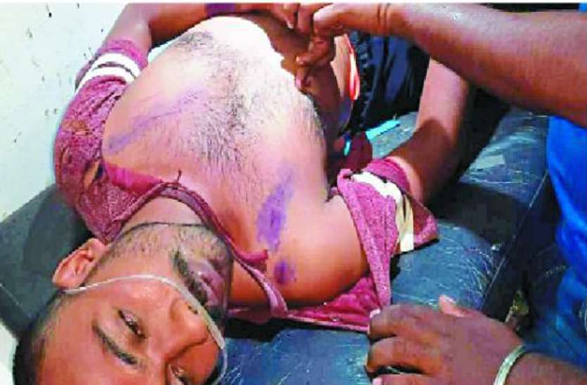 यूथ कांग्रेस अध्यक्ष पर धारदार हथियार से जानलेवा हमला, अंधेरे का फायदा उठाकर भाग खड़े हुए दो नकाबपोश यूथ कांग्रेस अध्यक्ष पर धारदार हथियार से जानलेवा हमला, अंधेरे का फायदा उठाकर भाग खड़े हुए दो नकाबपोश