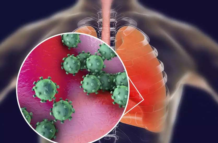 Coronavirus in UP खतरनाक होता जा रहा कोविड-19, बना रहा शरीर में ब्लड क्लॉटिंग, इससे हो रही जल्दी मौतें, डॉक्टर का दावा