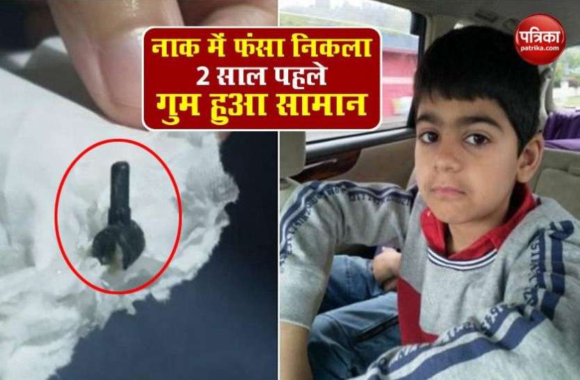 Lego piece stuck in New Zealand boy's nose for two years OMG: 2 साल पहले बच्चे के नाक में फंसा lego piece,अब छींक के साथ निकला बाहर !