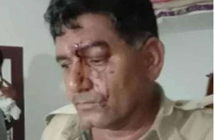 महिला को छुड़ाने ससुराल पहुंची पुलिस पर हमला, एएसआइ व कांस्टेबल घायल महिला को छुड़ाने ससुराल पहुंची पुलिस पर हमला, एएसआइ व कांस्टेबल घायल