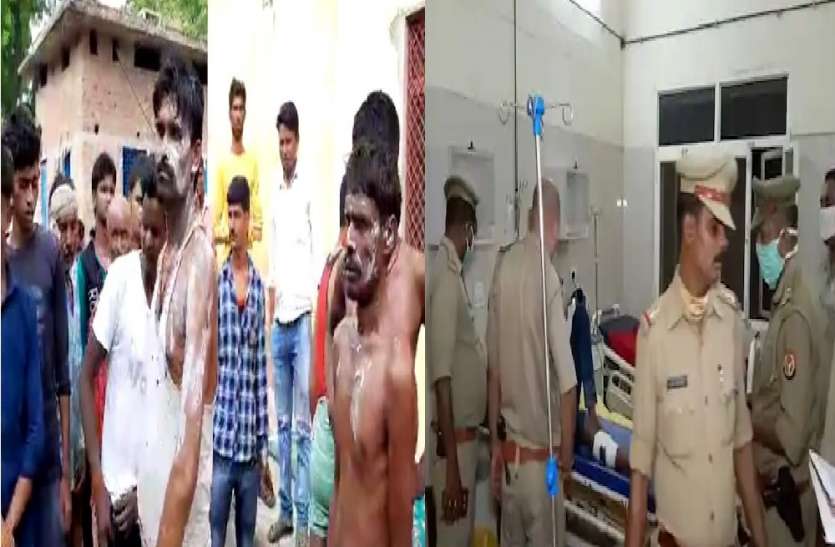 पानी भरने के विवाद में एसिड अटैक, 23 लोग झुलसे पानी भरने के विवाद में एसिड अटैक, 23 लोग झुलसे