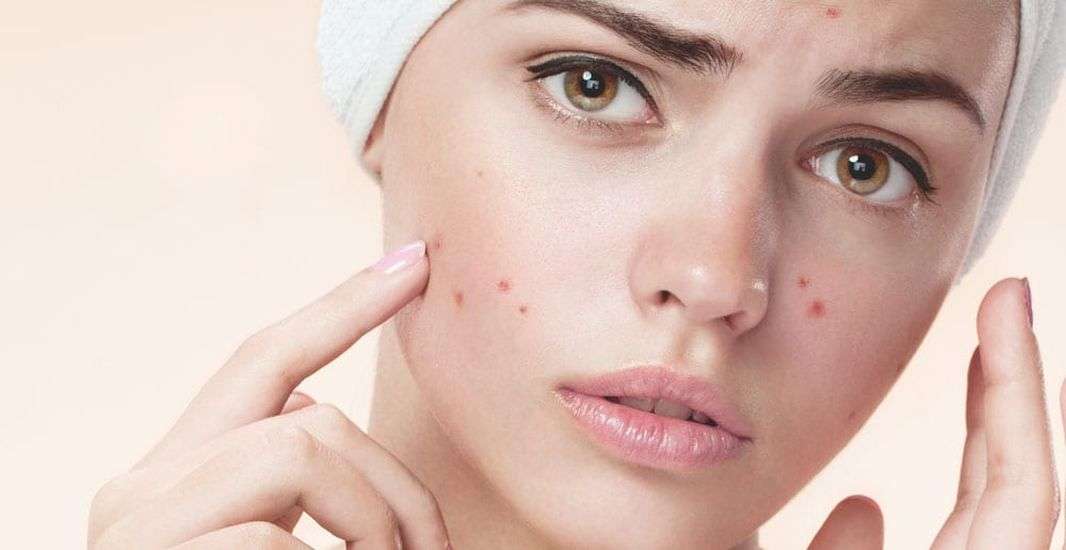 लाइफ स्टाइल: जानिये स्ट्रैस हमारे चेहरे पर क्या असर डालता है?