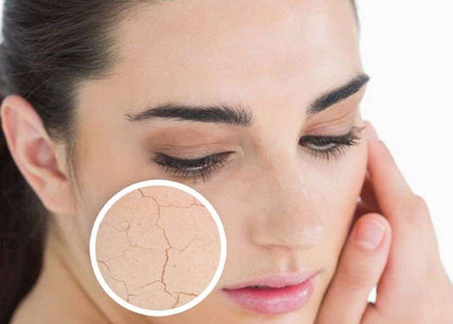 लाइफ स्टाइल: जानिये स्ट्रैस हमारे चेहरे पर क्या असर डालता है?