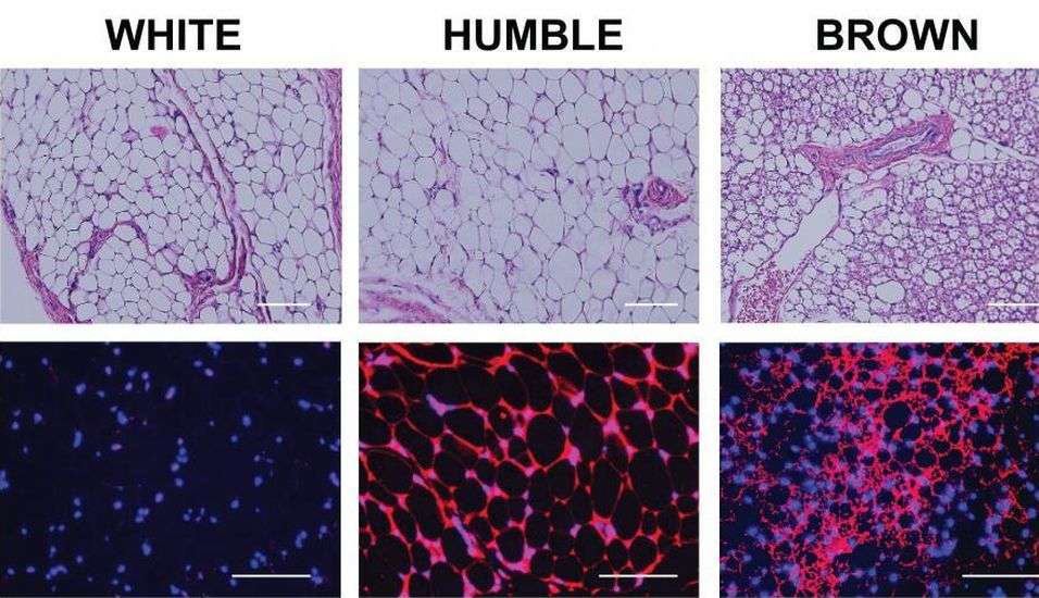 मेडिकल साइंस: अनुवांशिक रूप से डिजायन किए गए वसा कोशिकाएं लड़ेंगीं मोटापे से