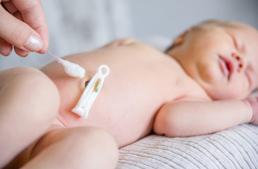 Como Proteger Al Bebe De La Infeccion Del Cordon Umbilical Como Proteger A Su Bebe De La Infeccion Del Cordon Umbilical