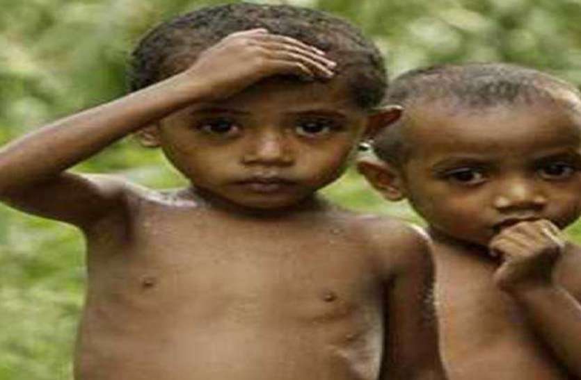 malnourished children बाल कल्याण समिति ने मांगी कुपोषित बच्चों की जानकारी