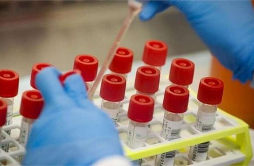 कोरोना के 28 नए मामले आए सामने कोरोना के 28 नए मामले आए सामने