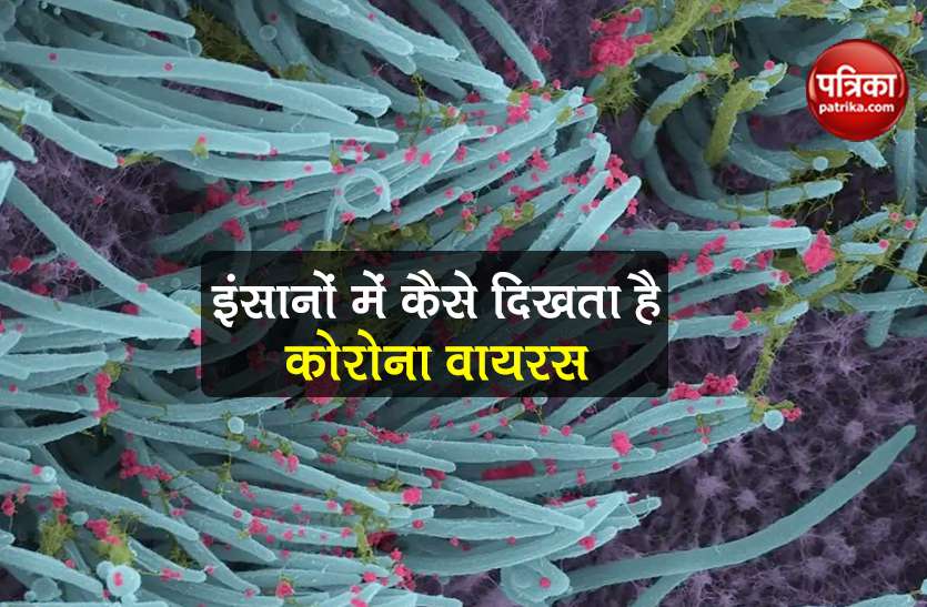 Coronavirus covid-19-infected-cells images out in human body Coronavirus: कोरोना संक्रमित की पहली बार सामने आई ऐसी तस्वीरें, इसलिए जरूरी है मास्क पहनना