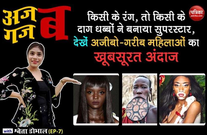 Worlds Most Beautiful Women Who Known By Her Epic Style किसी के रंग, तो किसी के दाग धब्बों ने बनाया सुपरस्टार, देखें अजीबो-गरीब महिलाओं का खूबसूरत अंदाज: अजब गजब with Shweta Dhobhal (EP-7)