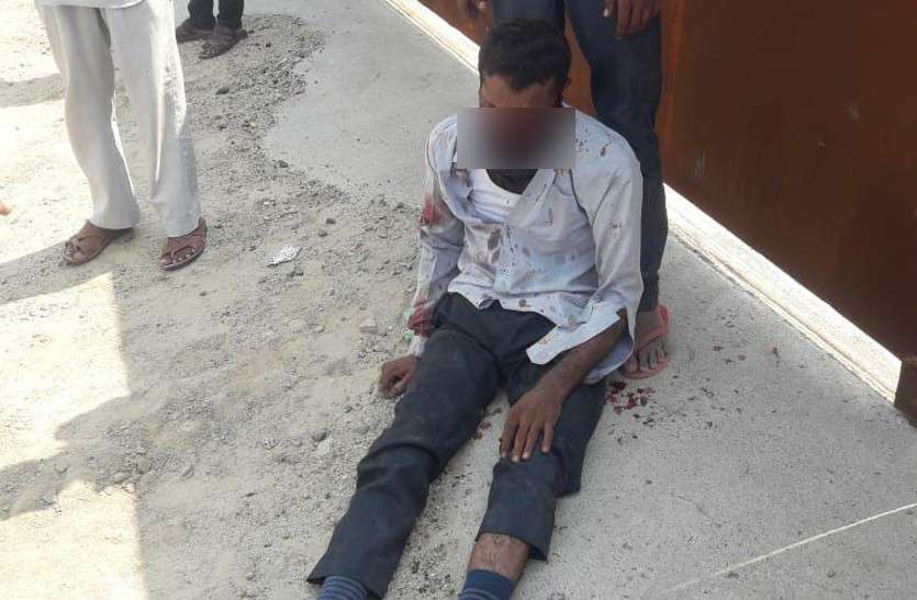 teacher nose cut in barmer बाड़मेर: प्रेम-प्रसंग के चलते शिक्षक का काटा नाक व कान, गंभीर घायल
