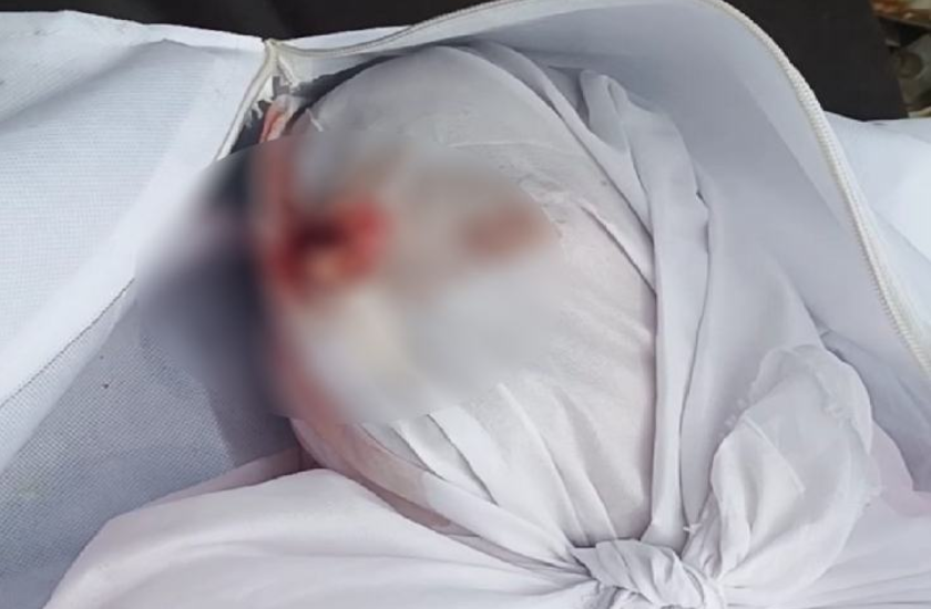 नरकंकाल के बाद इंदौर के अस्पताल में एक और गंभीर मामला, चूहाें ने कुतरा बुजुर्ग का शव