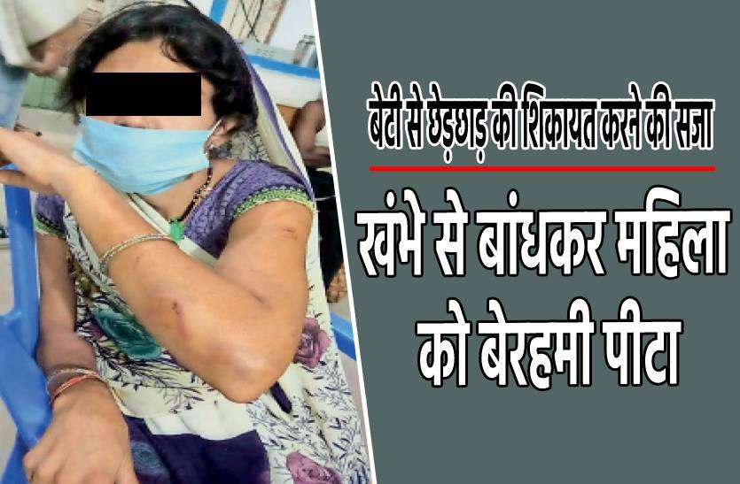 sagar.jpg बेटी से छेड़छाड़ की शिकायत की तो महिला को खंभे से बांधकर पीटा, डायल-100 के पहुंचने से बची जान