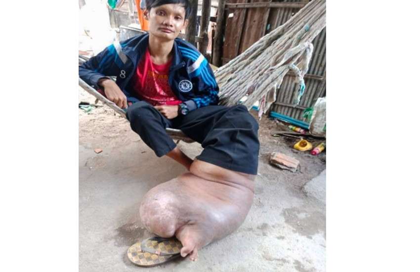 Bong Chet